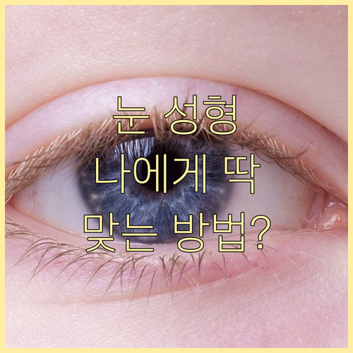 인상 좌우하는 눈, 나에게 맞는 눈 성형 방법은? 종류별 상세 분석